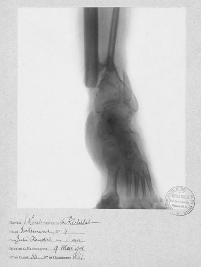 LABORATOIRE CENTRAL DE RADIOLOGIE DE PARIS Radiographie d'un pied, 9 mai 1901. Tirage...