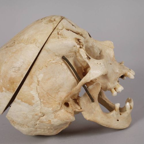 Null 
Modelo médico ilustrativo
de edad indeterminada, cráneo humano con casquet&hellip;