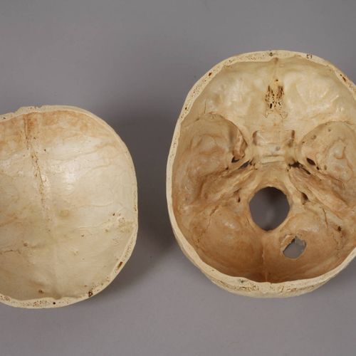 Null 
Modelo médico ilustrativo
de edad indeterminada, cráneo humano con casquet&hellip;