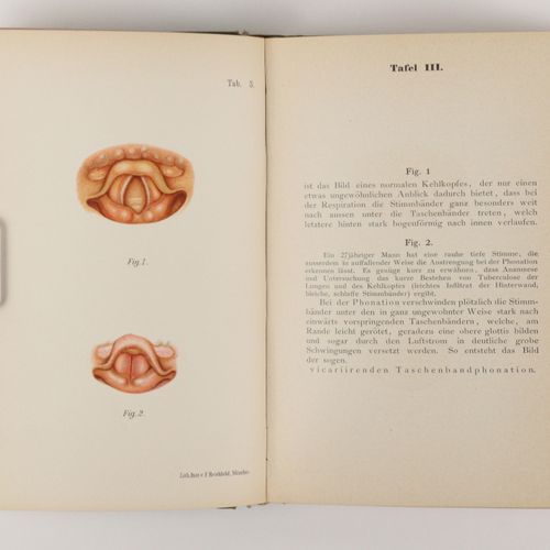 Grünwald, Dr. L. Atlas und Grundriss der Kehlkopfkrankheiten, München 1897, Verl&hellip;