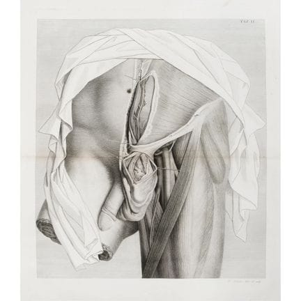 Scarpa, Antonio. Anatomical and Surgical Treatise 