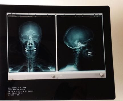 Damien Hirst
Rx Self-portrait - 2010

Pubblicato i