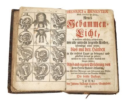 Nouvelle lumière pour les sages-femmes, 1728
Deux 
