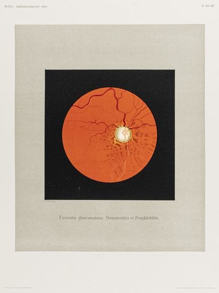 Medicina - Oftalmologia - Oeller, Johann Nepomuk. 