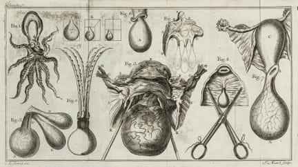 Medicine - Levret, André. Observations on the Radi