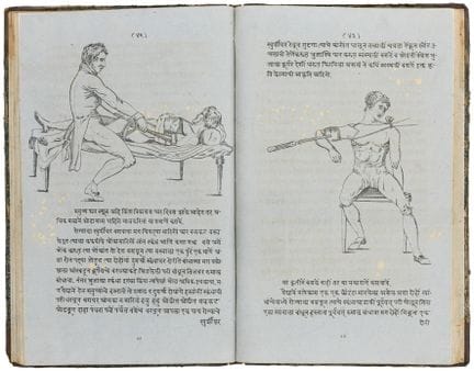 Medicine - McLennan, John. *Fractures and Dislocat
