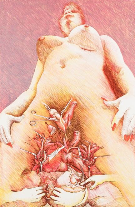 Schlick, Wolfgang. Transplants. 9 farbige Original