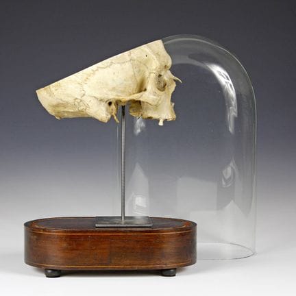 Medicina e Farmacia - Preparato anatomico di un cr