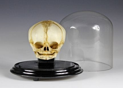Medicina e Farmacia - Cranio preparato di un neona
