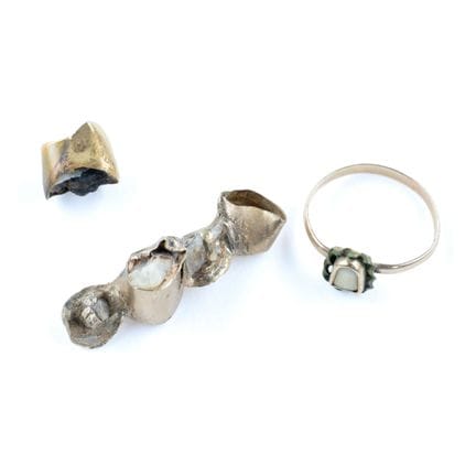 Set bestehend aus: Zahngold und einem Ring aus 18-
