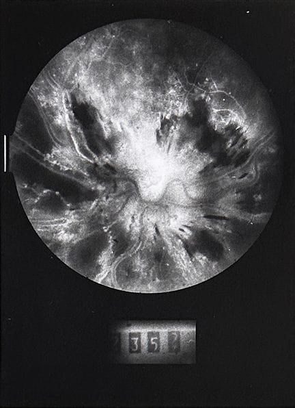 ANDRÉ STEINER 1901-1978. 
Photographies médicales,