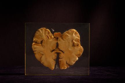 [ARTIFICIALIA]
Pierre GIRAUDON (1923-2012) - BIOPL