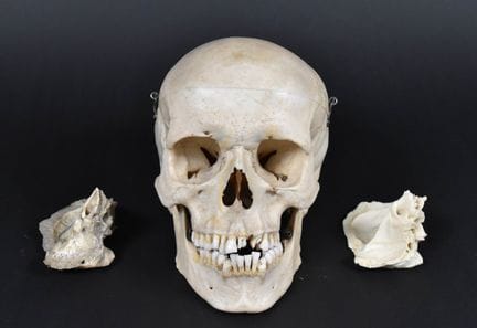 Muestra anatómica didáctica de un cráneo humano co