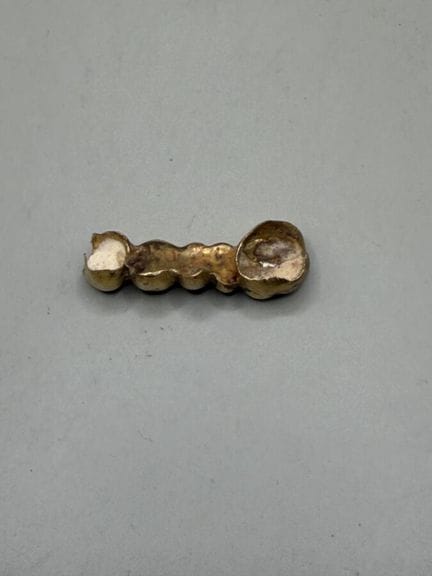 Set di oro dentale, peso lordo 10,4 g.