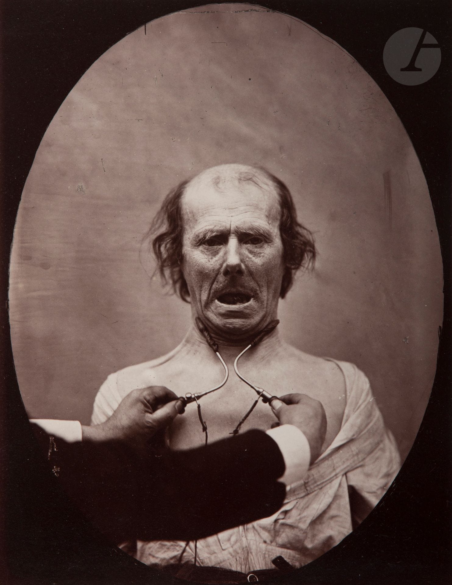 Guillaume Duchenne de Boulogne (1806-1875) - Adrien Tournachon (1825-1903)
Mécanisme de la Physionomie Humaine ou Analyse Electro-Physiologique de l’Expression des Passions, 1854-1856.
Modèle masculin. 
Épreuve sur papier albuminé (1862), contrecollée sur carton. 
22,3x17,3cm

Bibliographie:
Guillaume Duchenne de Boulogne, Mécanisme de la physionomie humaine, ou Analyse électrophysiologique de l’expression des passions, Paris, Vve J. Renouard, 1862, fig. 59.