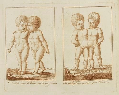 MILLOT (Jacques-André)
L'Art de procréer les sexes à volonté, ou systême complet de génération. Paris: Millot, Migneret, Pernier, Germinal an IX (1801). - In-8, xvj, 415 pp. ch. 387, 5 pl. Demi-basane havane à coins de vélin ivoire, dos lisse orné, tranches jaunes (reliure de l'époque). Seconde édition rare, après celle de 1800, revue et augmentée, de ce curieux traité de Jacques-André Millot (1738-1811), chirurgien-accoucheur de Marie-Antoinette et des duchesses d'Orléans et de Bourbon. Dans cet ouvrage, l'auteur indique "le moyen de procréer à volonté le Sexe que l'on désire", et donne également des recettes contre la stérilité et les malformations. Si l'on peut croire au premier abord à une supercherie, ce traité a été fait le plus sérieusement du monde; relégué aujourd'hui au rang de chimère, il eut à l'époque un très grand succès puisqu'il fut publié plusieurs fois jusqu'en 1828. Millot présente ainsi son point de vue: "Je ne crois pas pouvoir rendre un plus grand service à l'humanité, que de lui donner le mode de procréer les Sexes à volonté; car cette connaissance a aussi son but Moral: c'est, je crois, le seul moyen d'augmenter, s'il est possible, la tendresse des Pères et Mères, et l'attachement des Enfans pour eux, parce que les parens qui n'auront que des Enfans de leur choix, les verront avec une satisfaction continuelle" (pp. xiij-xiv). L'édition est illustrée de 5 planches, la première en noir représentant Adam et Eve enlacés, et 4 en bistre, dont 3 dépliantes, comprenant 9 figures dont 8 représentant des malformations humaines et animales. Exemplaire du dessinateur Gabriel Béguillet avec la mention "à Mr Gabriel Béguillet" sur le premier contre-plat. Manque à la coiffe de tête, coins légèrement émoussés. Déchirures sans manque aux deux derniers feuillets, galerie de ver aux derniers feuillets de garde.