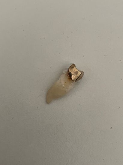 *Dent or avec plombage

Poids brut : 2 g

(*...