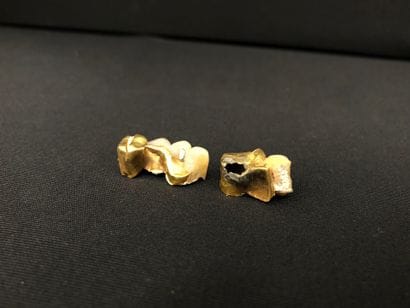 Dental GOLD
Gross weight: 9g.