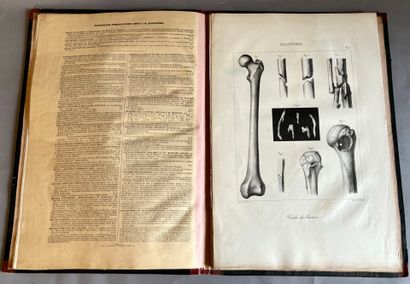 (Medicine). MALGAIGNE (F.-J.). Treatise on...