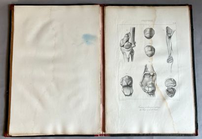 (Medicine). MALGAIGNE (F.-J.). Treatise on...