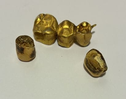 Yellow gold teeth 
Gross weight: 9.6g
