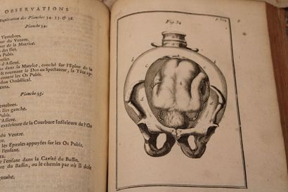 [OBSETRIQUIE], DEVENTER (Henry de), Observations...