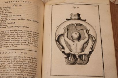 [OBSETRIQUIE], DEVENTER (Henry de), Observations...