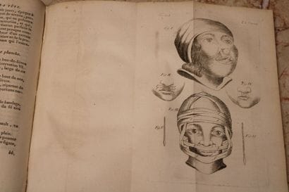 [MEDECINE], BICHAT (Xavier). OEUVRES CHIRURGICALES,...