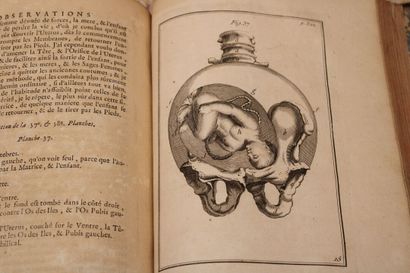 [OBSETRIQUIE], DEVENTER (Henry de), Observations...