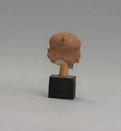 Head of a notable with a deformed skull....