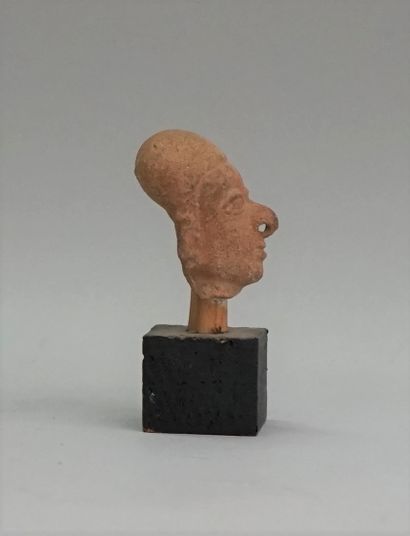 Head of a notable with a deformed skull....