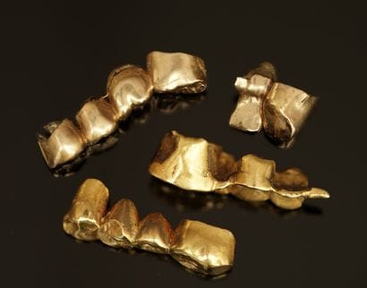 LOT D'OR DENTAIRE. PB: 31.6g. (à nettoyer...