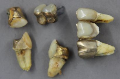 Lot de plombages en or 18k, pds brut : 23...