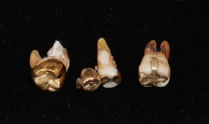 Lot d’or dentaire 14k.
Pds brut : 14, 66...