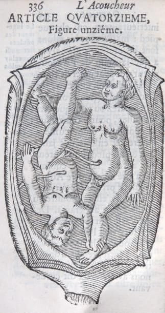 FOURNIER (D)
L'accoucheur méthodique qui...
