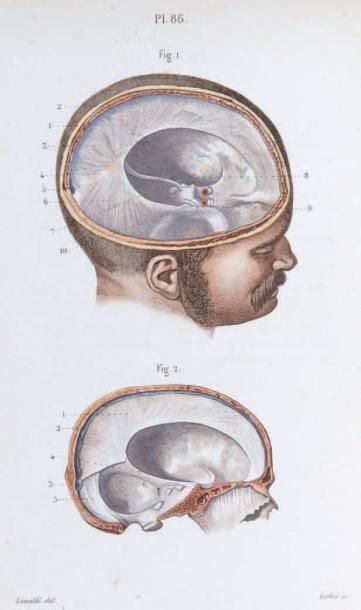 MASSE (J.N)
Petit Atlas complet d'Anatomie...
