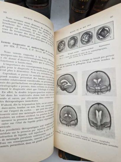 [PSYCHIATRY]. Annales Médico-Psychologiques....