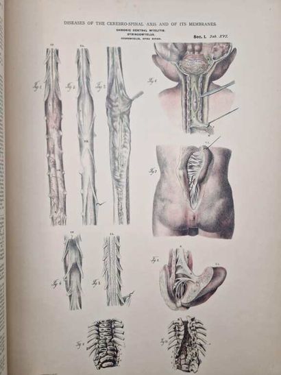 JEANCON, Jean. Pathological Anatomy, Pathology...