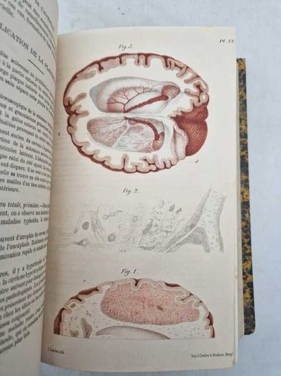 GRASSET, Joseph. Traité Pratique des Maladies...