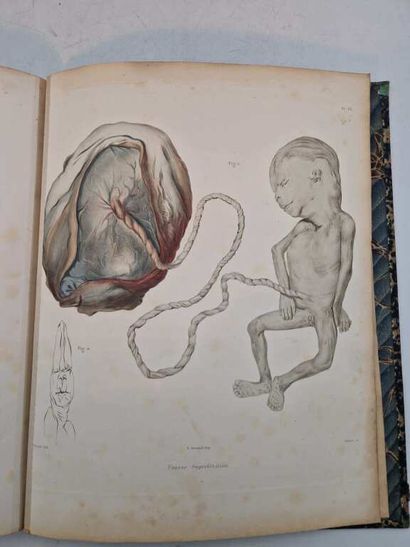 POUCHET, Félix Archimède. Théorie Positive...