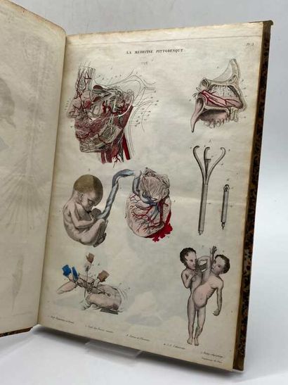 BAYLE, Antoine Laurent. La Médecine Pittoresque,...
