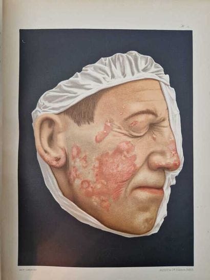 [ATLAS]. Le Musée de l'Hôpital Saint-Louis....