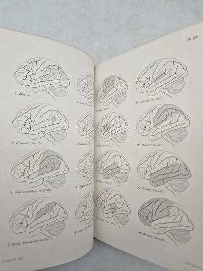 GRASSET, Joseph. Des Localisations des Maladies...