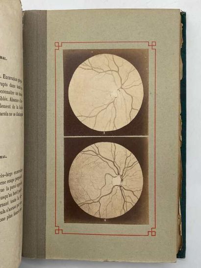 WECKER, Louis de and MASSELON, Julien. Ophthalmoscopie...