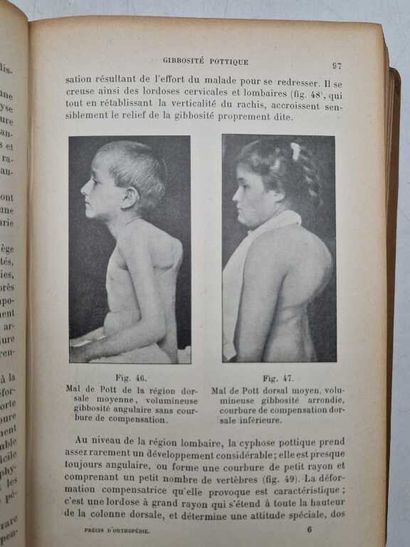 NOVE-JOSSERAND, Gabriel. Précis d'Orthopédie,...