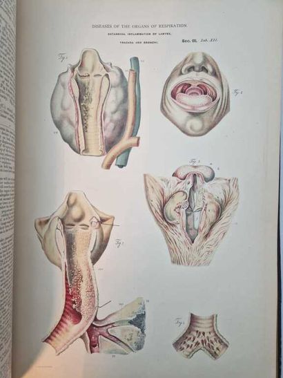 JEANCON, Jean. Pathological Anatomy, Pathology...