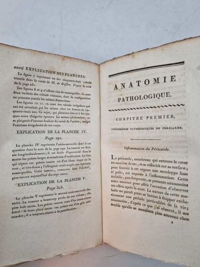 BAILLIE, Mathieu. Anatomie Pathologique des...