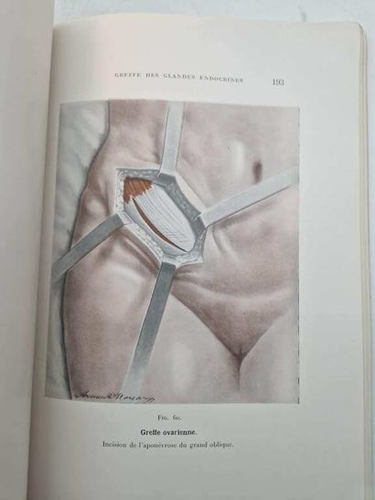 VORONOFF, Serge. Endoctrine Gland Transplantation....