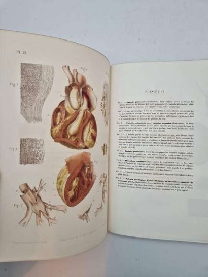 LANCEREAUX, Etienne and LACKERBAUER. Atlas...