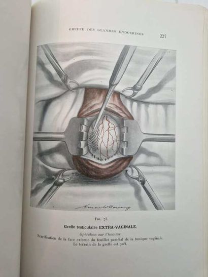 VORONOFF, Serge. Endoctrine Gland Transplantation....